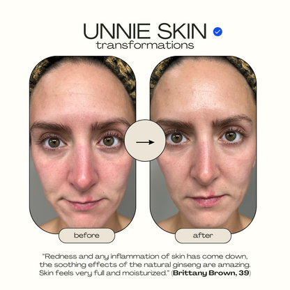 UNNIE™ SKIN Ginseng GLOW Anti-Sagging Serum (For Neck, Cheeks, Eye, Forehead Area)