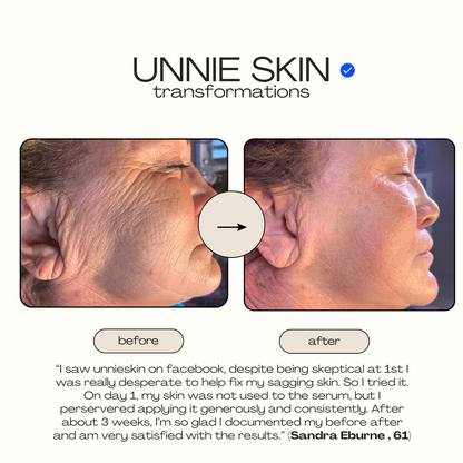 UNNIE™ SKIN Ginseng GLOW Anti-Sagging Serum (For Neck, Cheeks, Eye, Forehead Area)