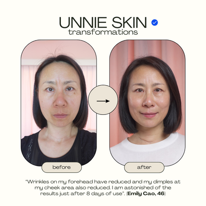 UNNIE™ SKIN Ginseng GLOW Anti-Sagging Serum (For Neck, Cheeks, Eye, Forehead Area)